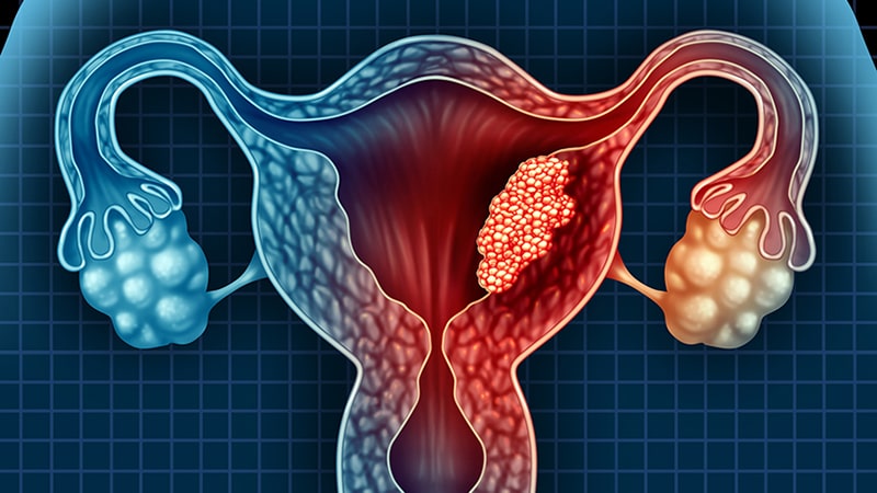 ung thư nội mạc tử cung có thể để lại những di chứng về lâu dài cho người bệnh