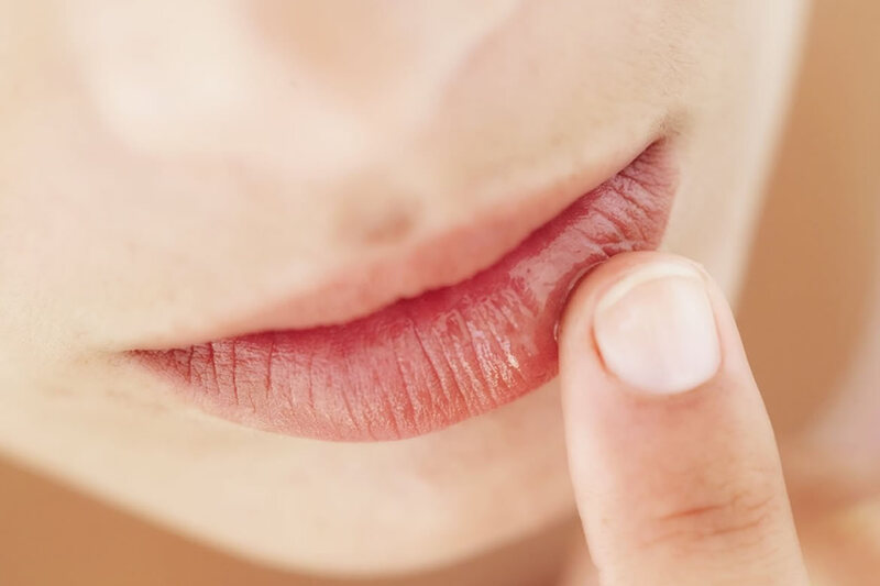 Bôi thuốc mỡ giúp làm dịu và nhanh phục hồi do Herpes môi