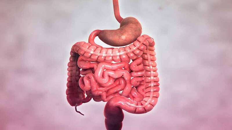 bệnh Crohn gây viêm ruột nhiều vùng