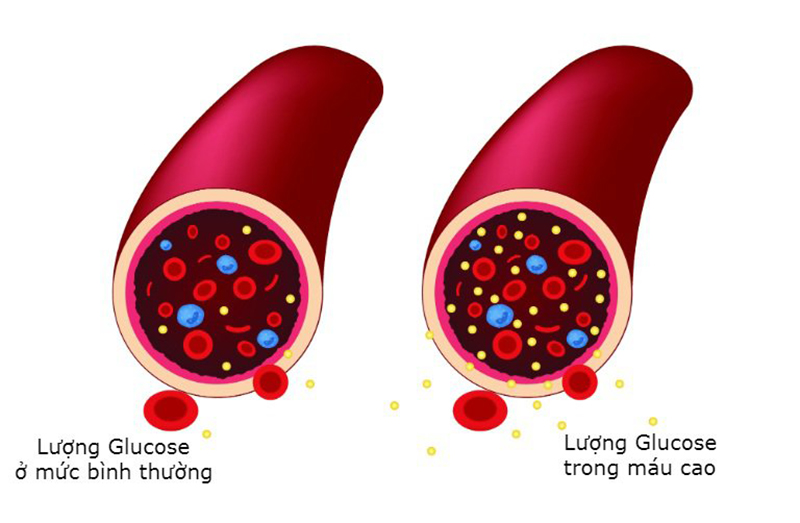 Kết quả xét nghiệm HbA1c phản ánh nồng độ glucose trong máu