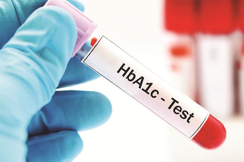 Xét nghiệm HbA1c không có khả năng thay thế các xét nghiệm máu thông thường