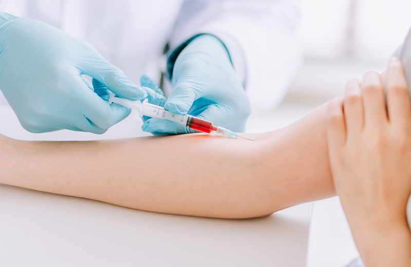 Phương pháp lấy mẫu máu xét nghiệm từ tĩnh mạch tay