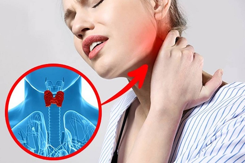Người bị u tuyến giáp lành tính thường sờ thấy cục u nổi lên ở cổ