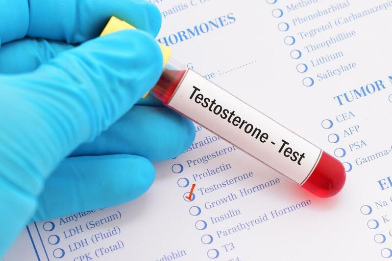 Đo nồng độ Testosterone để chẩn đoán rối loạn cương dương ở người bị đái tháo đường