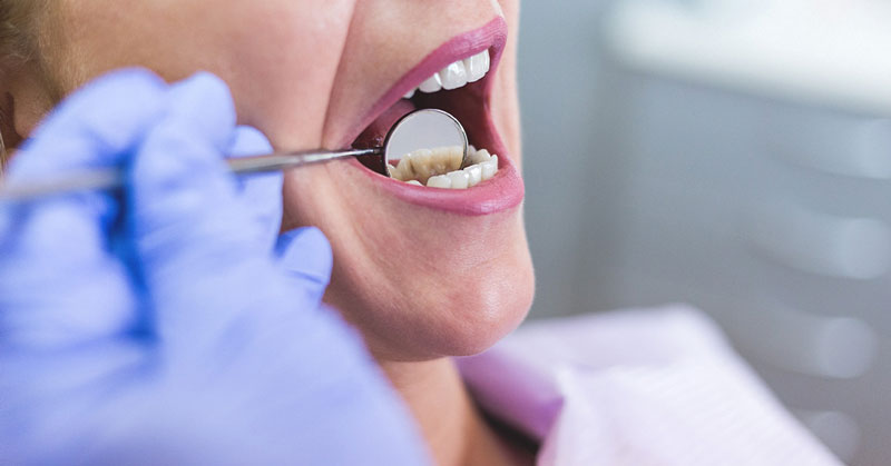 Bạn nên đi kiểm tra răng miệng thường xuyên