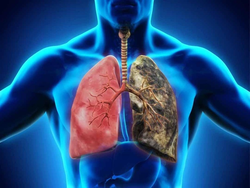 Tổn thương hoặc bệnh lý làm tăng cao áp lực động mạch phổi đều có thể gây tâm phế mạn
