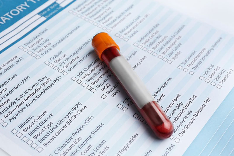 Người ngoài 30 tuổi cần xét nghiệm kiểm tra lượng mỡ máu