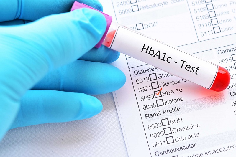 Nồng độ HbA1C cao hơn 6.4% khi bị bệnh