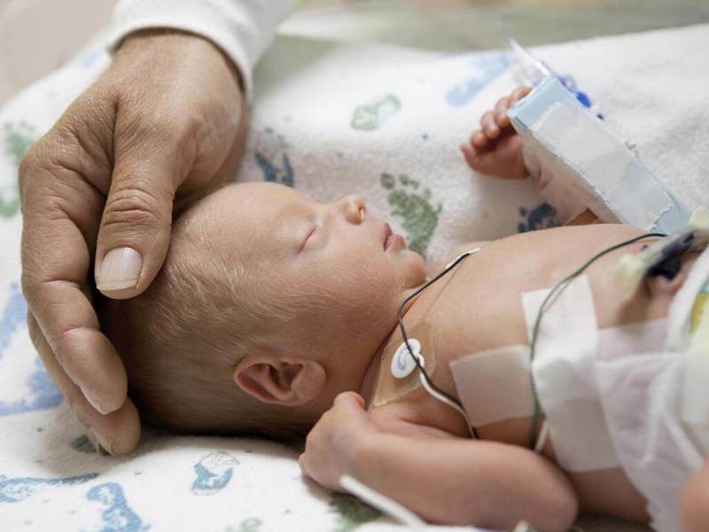 suy giáp bẩm sinh thường xuất hiện ở trẻ sơ sinh
