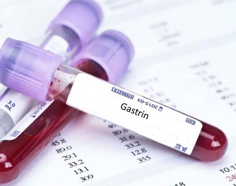 Thế nào là kiểm tra nồng độ hormone Gastrin
