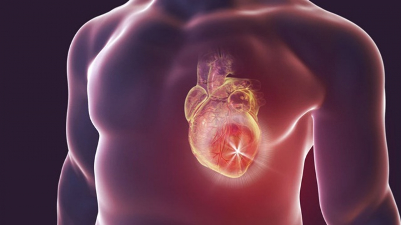 Cao huyết áp có thể gây suy tim nếu không kiểm soát tốt