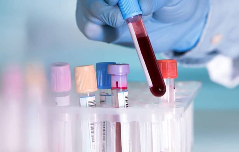 Xét nghiệm máu giúp kiểm tra sức khỏe của thận