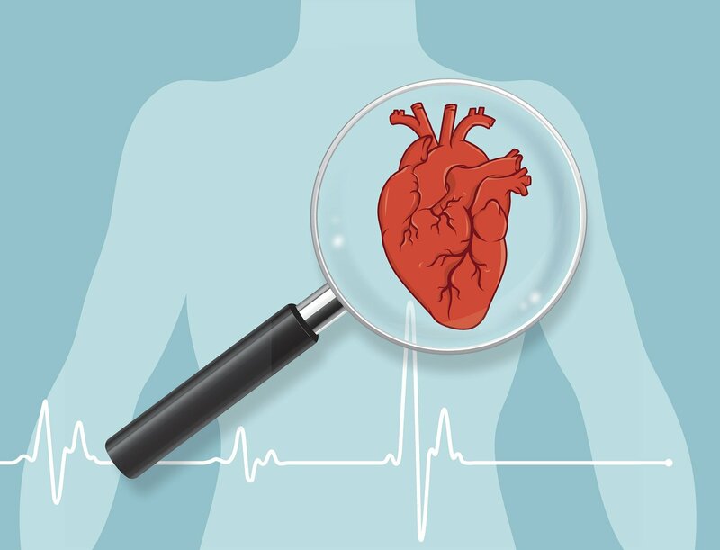 Cần kết hợp kỹ thuật khác để chẩn đoán nhồi máu cơ tim