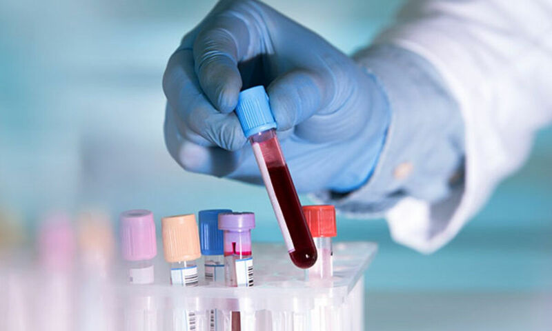 Xét nghiệm sinh hóa thường dùng trong theo dõi nhồi máu cơ tim