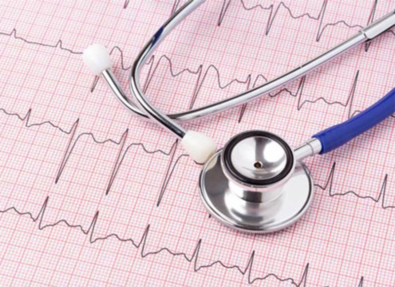 Phương pháp ECG thiếu máu cơ tim được áp dụng để chẩn đoán tình trạng bệnh