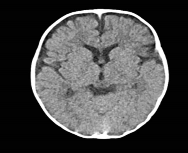 Nhờ chụp CT đầu, chúng ta có thể phát hiện những tổn thương của não bộ