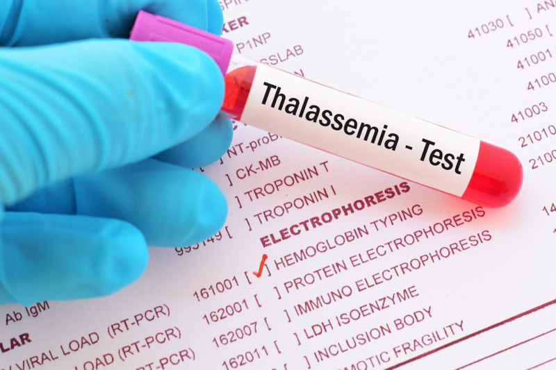 Phát hiện sớm Thalassemia ở thai nhi và trẻ nhỏ giúp điều trị bệnh hiệu quả hơn