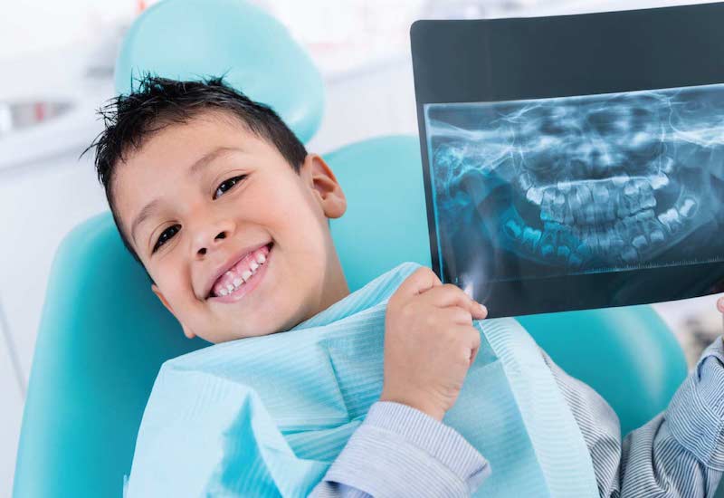 Chụp X-quang cho trẻ khi bé gặp các vấn đề về răng