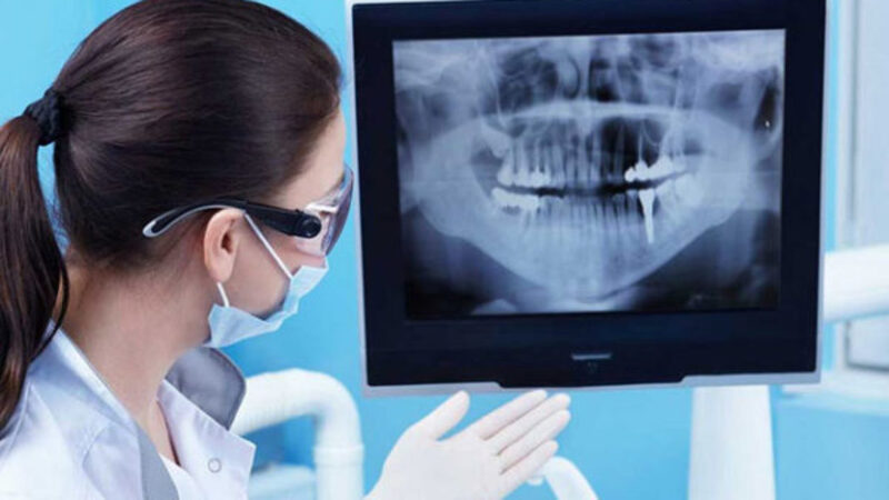 Vùng xương răng hấp thu X-quang tốt hơn nên có màu trắng trên phim chụp