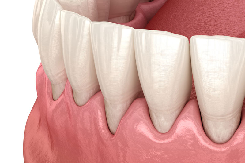Nội tiết tố thay đổi có thể khiến răng dễ bị bệnh