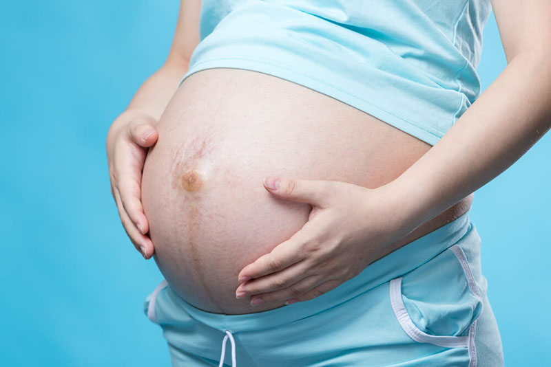 Phụ nữ mang thai có thể mắc thoát vị bẹn