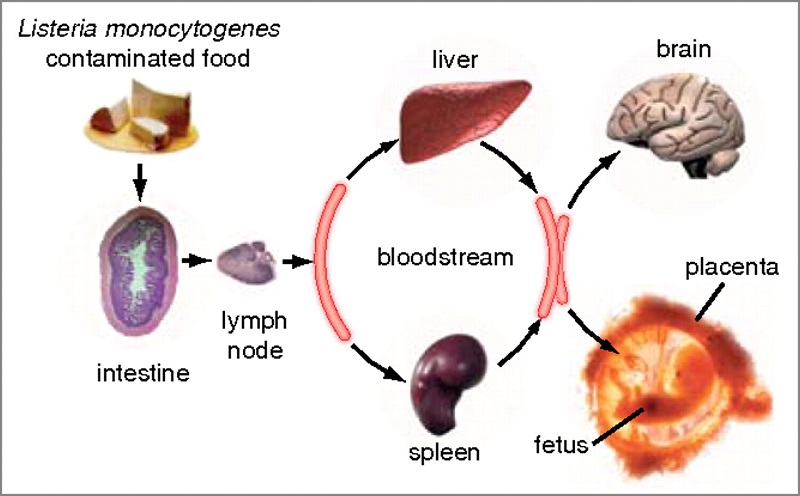Vi khuẩn Listeria monocytogenes gây nhiễm trùng, trường hợp nặng có thể gây suy đa tạng, tử vong.