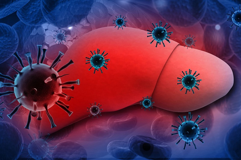 Virus viêm gan E có thể tiến triển mãn tính gây ra bệnh nguy hiểm cho gan