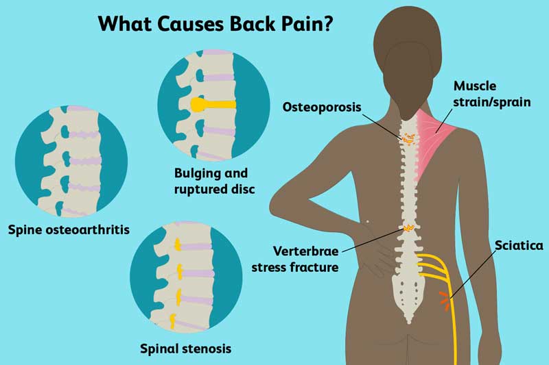 Bài tập điều trị đau cột sống thắt lưng