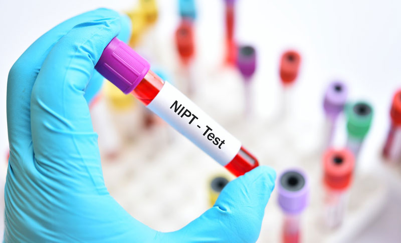 Xét nghiệm sàng lọc trước sinh NIPT được áp dụng phổ biến