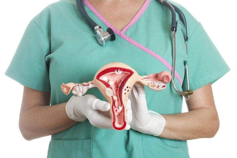 U xơ tử cung có thể gây vô sinh hiếm muộn