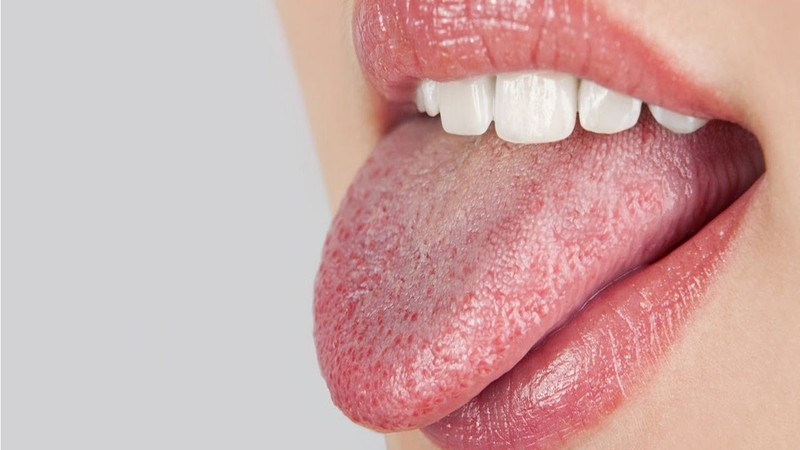 Khô miệng ảnh hưởng rất lớn đến sức khỏe răng miệng
