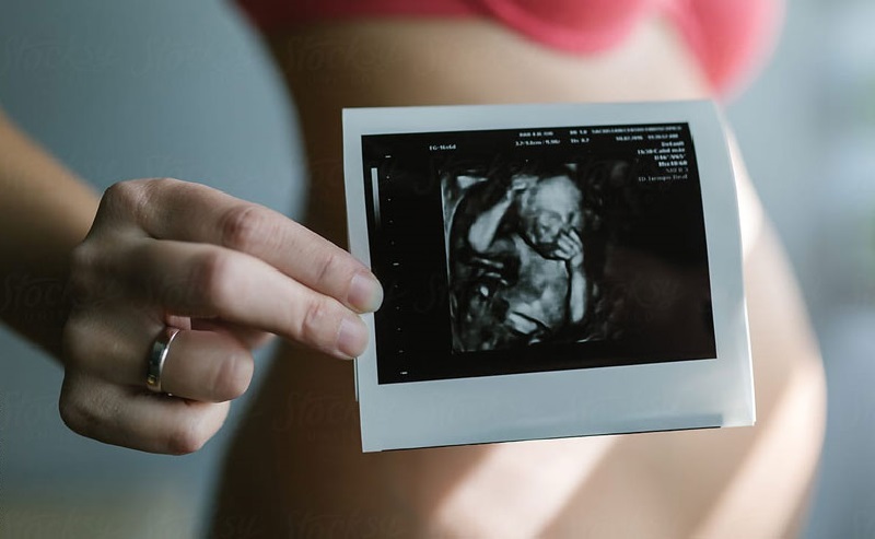 Siêu âm thai 2D để đánh giá tình trạng nước ối nhưng siêu âm thai nhi 2D nhiều có an toàn không? 