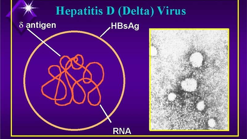 Virus viêm gan D (Hepatitis D virus)