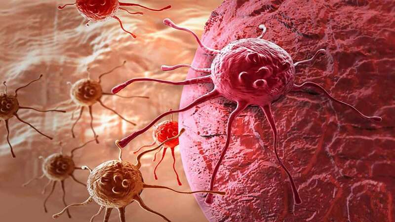 Tăng sinh mạch máu giúp tế bào ung thư di căn