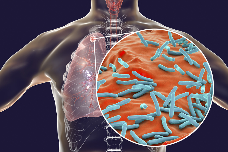 Vi khuẩn lao có trong nhiều dịch cơ thể
