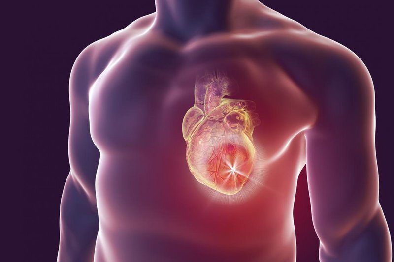 Nhiễm trùng tim xảy ra khi vi khuẩn hoặc virus tấn công gây viêm ở tim