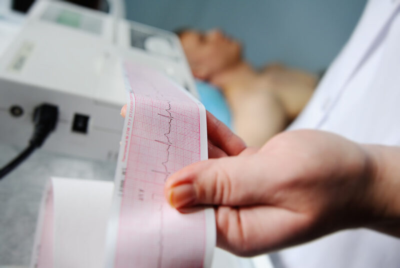 Điện tim giúp đánh giá tổn thương tim về mặt điện học