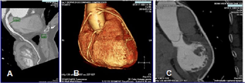 Hình ảnh từ cộng hưởng từ tim giúp bác sĩ chẩn đoán chính xác bệnh
