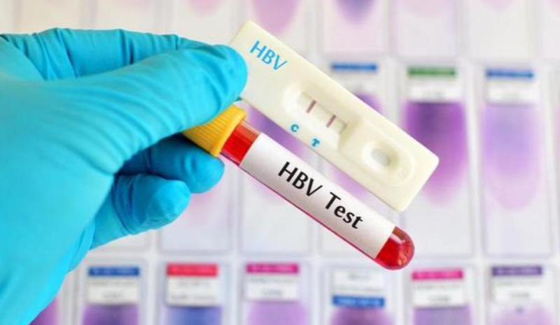 Có nhiều xét nghiệm HBV cung cấp các thông tin chẩn đoán bệnh khác nhau