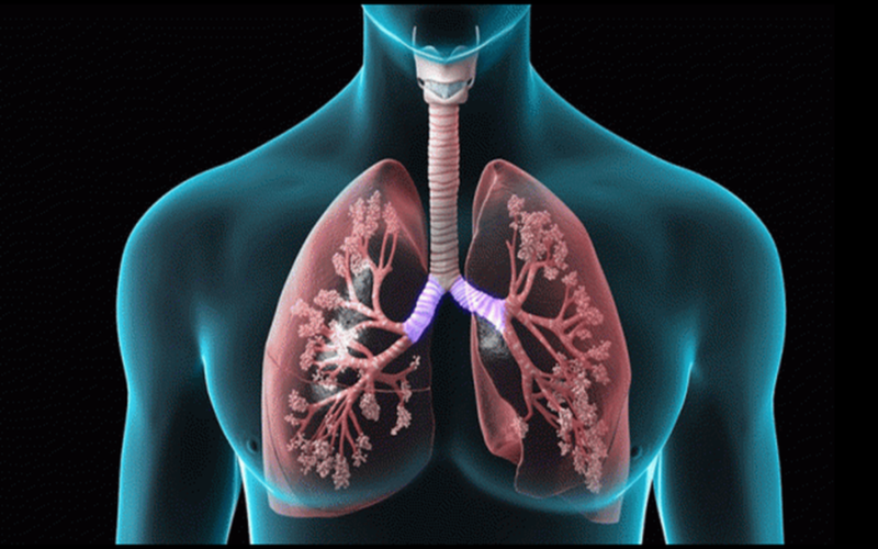Các biến chứng của xơ phổi