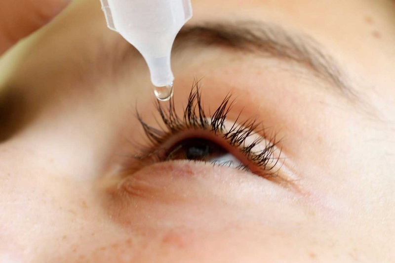 Dùng nước nhỏ mắt có thể giảm tình trạng khô mắt tạm thời