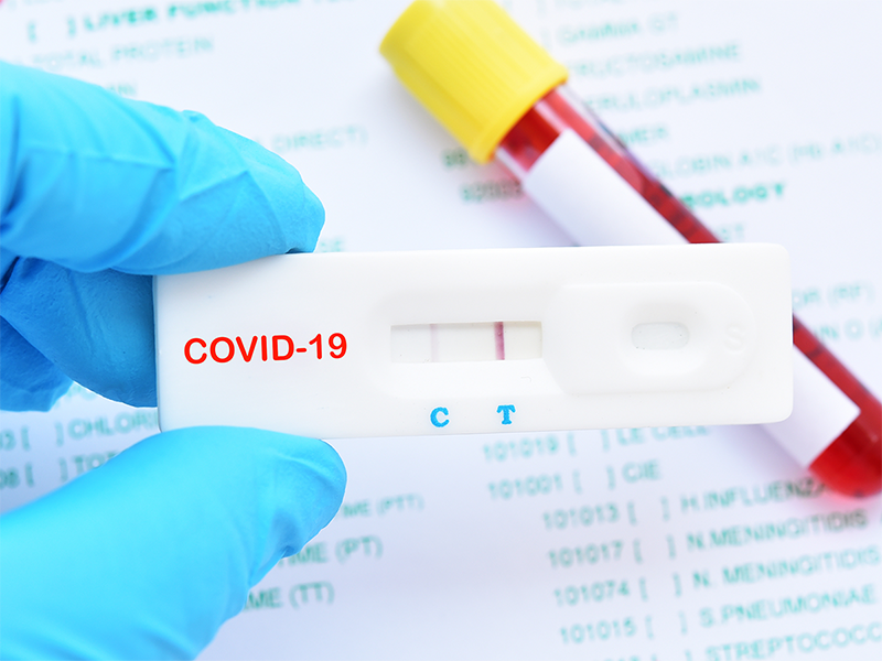 xét nghiệm COVID-19 có được bhyt chi trả