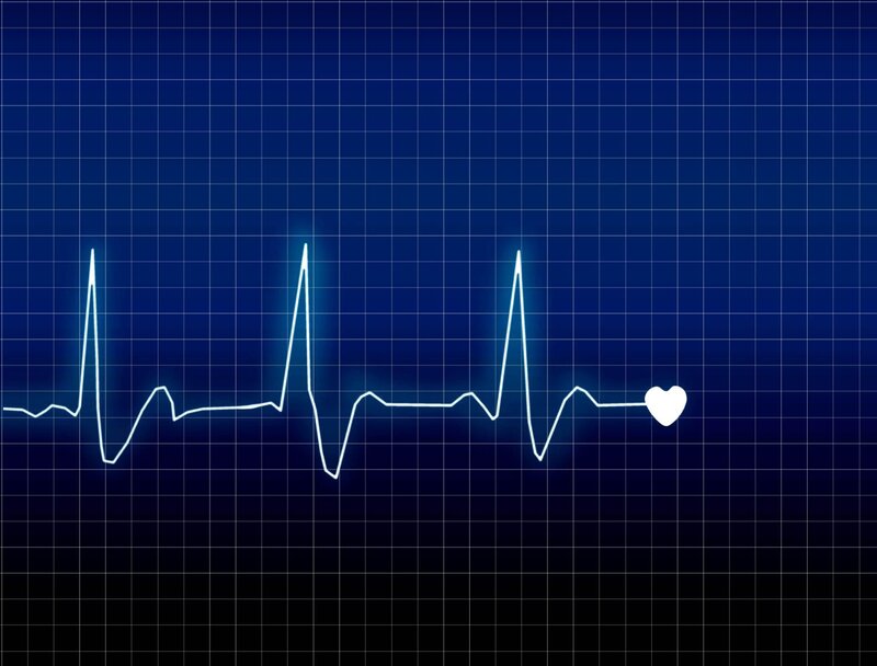Điện tâm đồ cho thấy bất thường trong hoạt động của tim