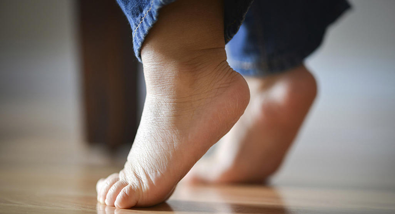Trẻ có bàn chân bẹt là triệu chứng phát triển không bình thường của xương bàn chân