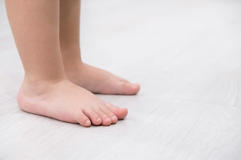 Bàn chân bẹt gây ảnh hưởng đến hoạt động đi lại của trẻ