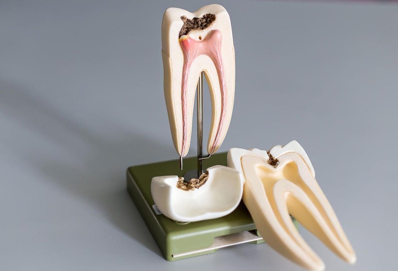 Lâm sàng rất hiếm gặp trường hợp viêm tủy răng có hồi phục