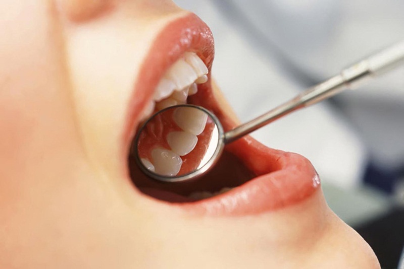 Nên khám răng định kỳ để phát hiện sớm những bệnh về nướu, răng miệng