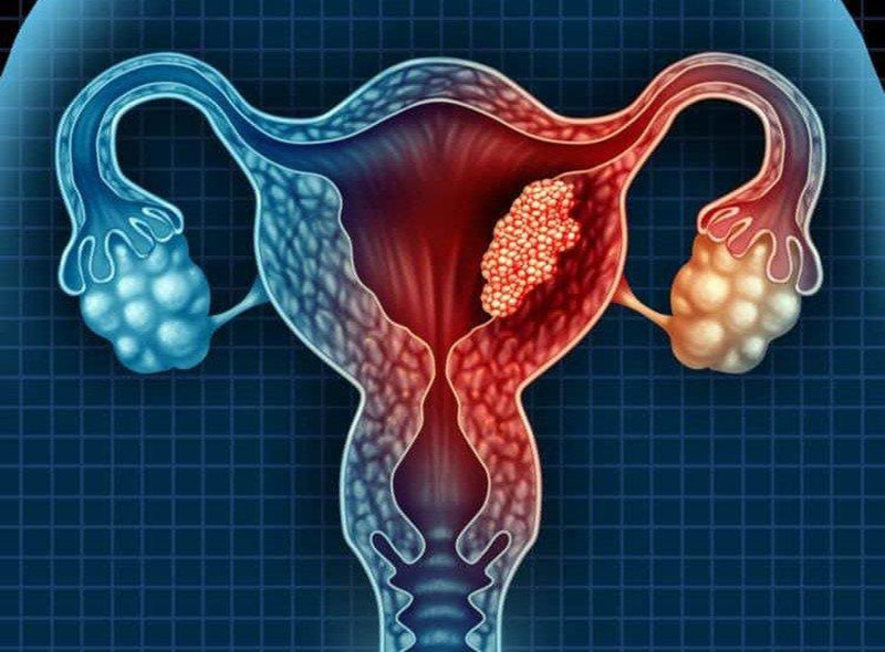Mô phỏng cấu tạo tử cung ở nữ giới
