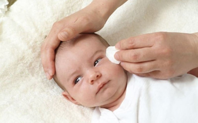 Hầu hết các trường hợp trẻ sơ sinh có vệt máu trong mắt là do xuất huyết dưới kết mạc