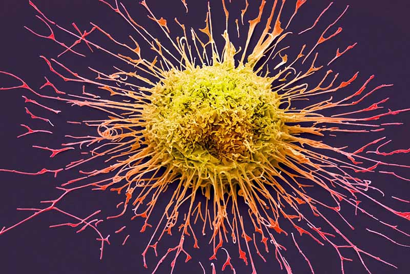 Hóa trị trong điều trị ung thư giúp ngăn chặn sự phát triển của các tế bào ác tính trong cơ thể 